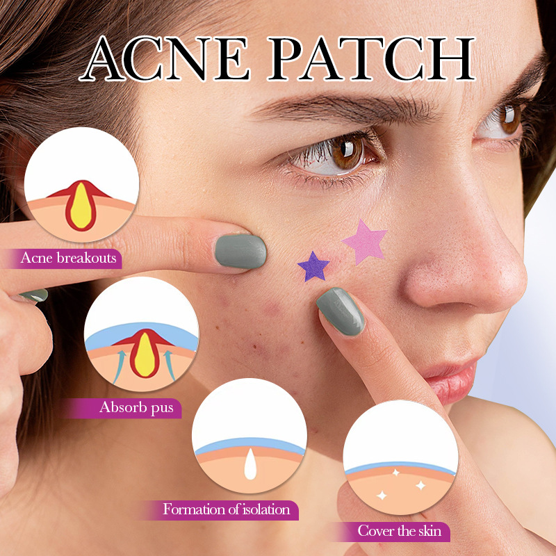 7/10/14 Pz Colorato Star Acne  - Skincare Qv recensione e prezzo