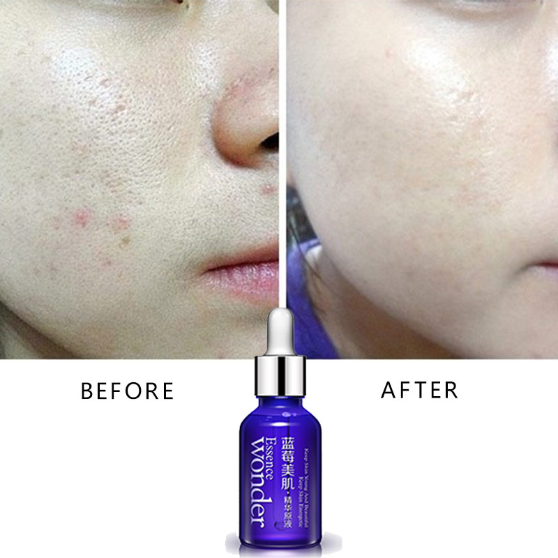 BIOAQUA siero Lifting viso mir - Skincare Bioaqua recensione e prezzo