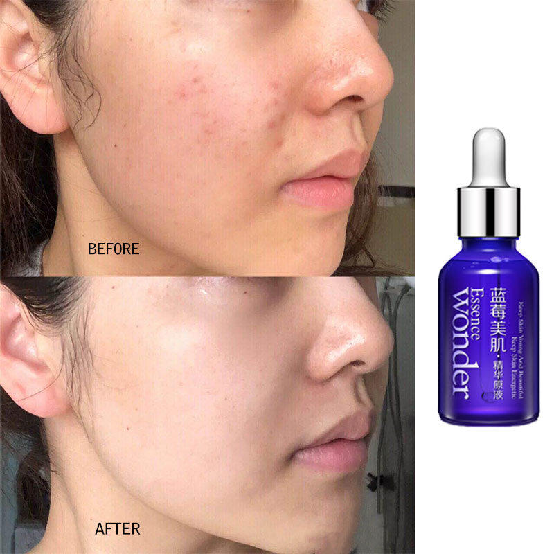 BIOAQUA siero Lifting viso mir - Skincare Bioaqua recensione e prezzo