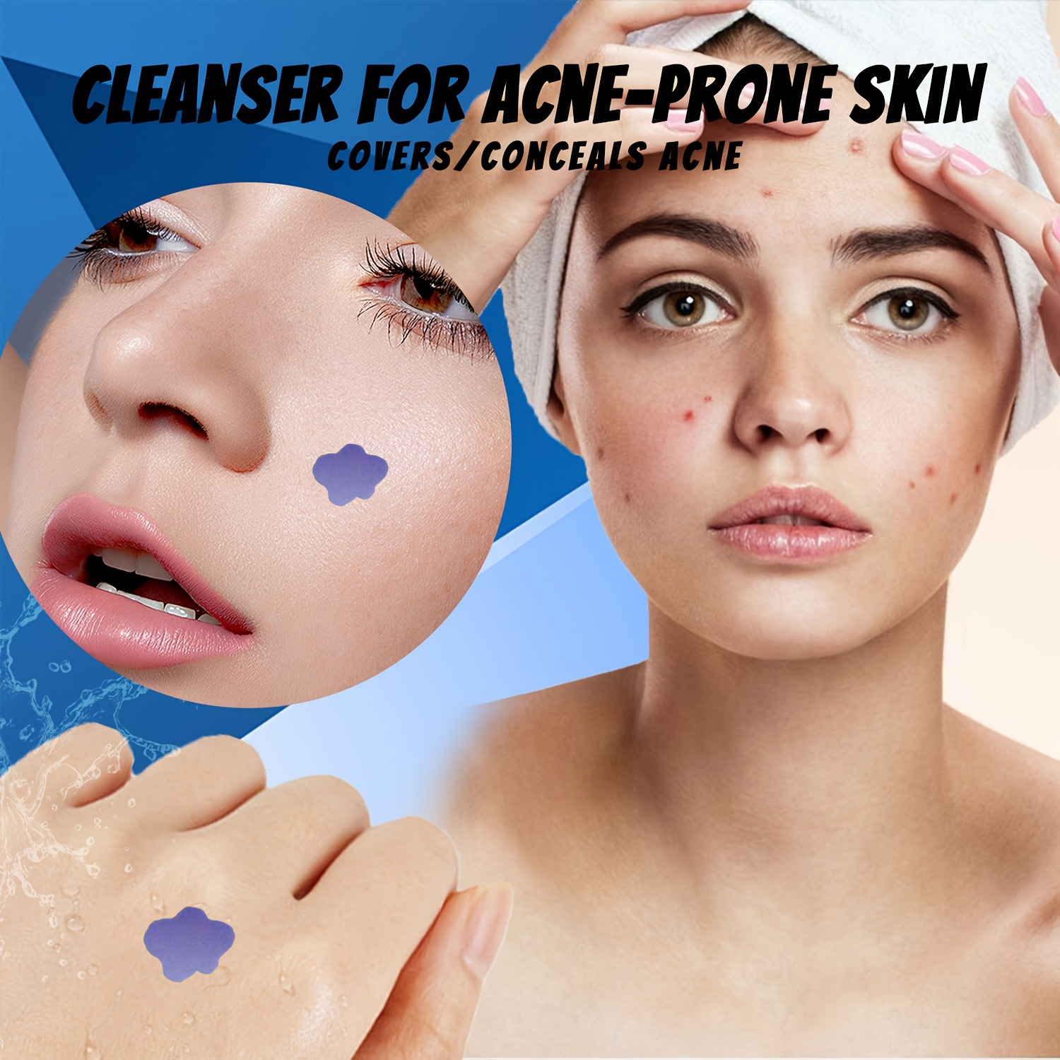 Cerotti Microneedle per Acne e - Skincare You recensione e prezzo